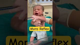 Moro reflex in newborn babyviral [upl. by Nylrac]