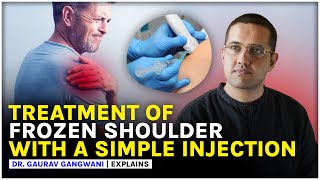 Frozen shoulder treatment without surgery  Shoulder pain  Dr Gaurav Gangwani [upl. by Lough]