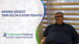 Kronik Sinüzit quotTıbbi Sülük ve Ozon Tedavisi quot [upl. by Asseniv]