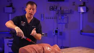 Emergency Pericardial Centesis Procedure Explained [upl. by Izzy]