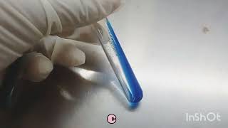 CITRATE test  Biochemicals in Microbiology  How to read [upl. by Lietman]