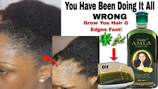 How To Use Rosemary and Amla Oil For Fuller n Thicker Hair Grow long hair amp prevent hair breakages [upl. by Tnaryb]