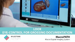 LOOX EyeControl for Grossing Documentation [upl. by Crudden]