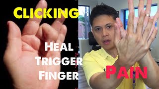 Paano mapagaling ang Trigger Finger Gawin ang 3 Best Exercises [upl. by Fi79]