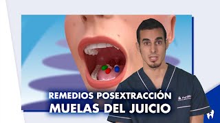 INFECCIÓN tras extracción dental ALVEOLITIS – Tratamiento síntomas y causas  Dentalk © [upl. by Ermina]