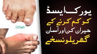 Uric Acid Treatment  Uric Acid ka ilaj uric acid home remedies  How to Reduce Uric Acid [upl. by Aydni]