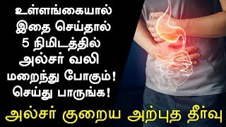 அல்சர் குணமாக வீட்டு வைத்தியம்  Ulcer Treatment in Tamil Ulcer Symptoms in Tamil Tamil Health Tips [upl. by Nevai]