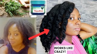 How I use Rosemary And Vapour Rub For Crazy Hair Growth You Can Grow Long Healthy Hair Too [upl. by Bull764]