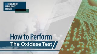 How to Perform the Oxidase Test [upl. by Bridgette527]