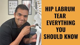 Hip Labrum Tears  Everything You Absolutely Need To Know [upl. by Leckie18]