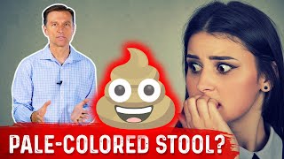 How to Check Your Health by Poop or Stool Colors [upl. by Atteuqahs]