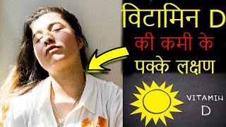 विटामिन D की कमी के 7 लक्षण 😱  Symptoms Of Vitamin D Deficiency [upl. by Rehpotsirc]