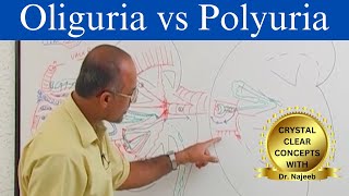 Oliguria vs Polyuria  Urine Output  Causes and Symptoms [upl. by Schaefer451]