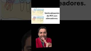 Verticalización de segundos molares inferiores en ortodoncia dentist odontología greenscreen [upl. by Akaya]