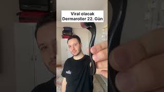 Dermaroller 22 Gün  Dermaroller saç çıkartır mı Dermaroller nedir Dermaroller nasıl kullanılır [upl. by Nillok]