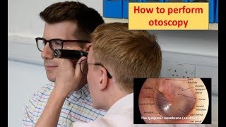 How to perform Otoscopy Ear Exam [upl. by Terag]