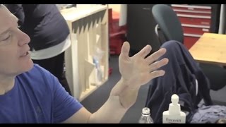 Experimental hand transplant procedure gives hope to patient  UCLA Health Newsroom [upl. by Naillik]