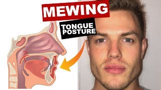 MEWING Tongue Posture  Train Your Tongue to Attach to Your Mouth [upl. by Eiruam]