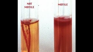 Motility Determination in Bacteria  Amrita University [upl. by Hayse756]