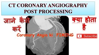 CT Coronary Angiography post processing Techniques CT Coronary Angiography Filming Film कैसे बनाएं [upl. by Valle68]