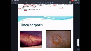 شرح Mycology Dermatophytes 1 [upl. by Lrub]