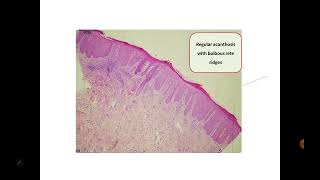 Dermpath3 Dr Rania Elakad [upl. by Lucier]