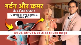 C4 C5 C5C6 amp L4 L5 L5 S1 Disc Bulge  गर्दन और कमर के दर्द का इलाज । Cervical Problem amp Back Pain [upl. by Barnie]