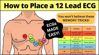 12 Lead ECG Placement MADE EASY EMT Nursing Paramedic ecg nursing [upl. by Gianna476]