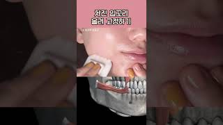 38세 팔자주름 최소화 입꼬리 올리기 Sagging lip coners Massage [upl. by Sutit]