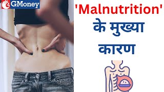 कुपोषण क्या है यह कैसे होता है Malnutrition in hindi [upl. by Macmillan]