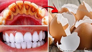 Can you whiten teeth at home in 2 minutes 😁✨ Secret that Dentists dont want you to know [upl. by Bryna904]