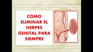 🔥😱 como ELIMINAR el HERPES GENITAL PARA SIEMPRE 🦁🔥 4 REMEDIOS naturales para curar el HERPES GENITAL [upl. by Ennagem]