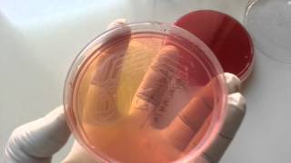 Salmonella Paratyphi isolated from blood culture [upl. by Farrison]