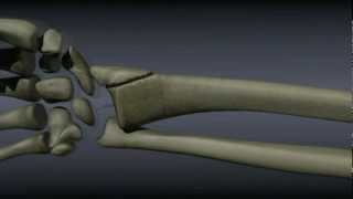 Surgical Treatment of Distal Radius Fractures [upl. by Fitts]