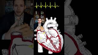 Sinus Tachycardia Animation and ECG shorts cardiology medical [upl. by Ayhdnas]