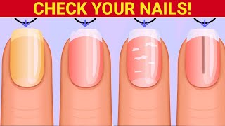 9 Things Your Nails Can Tell You About Your Health [upl. by Swithin]