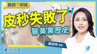 皮秒黑歷史大公開：我打皮秒失敗了 Part 1｜黃詩婷醫師｜淨妍醫美 [upl. by Swarts]