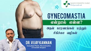 Demystifying Gynecomastia Causes Treatment and More  Tamil  Best cosmetic surgeon in salem [upl. by Notsnorb40]