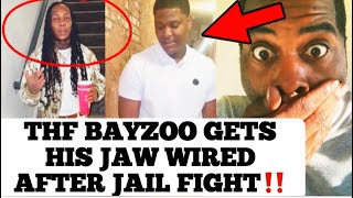 THF Bayzoo Gets His Jaw Wired After Fight In Jail The Video Leaked On The Net Was THF Zoo Lying [upl. by Nodnol613]