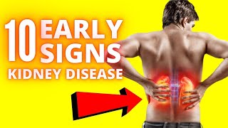 Early Signs of Kidney Disease  10 Warning Signs amp Symptoms [upl. by Leila]