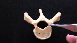 Typical Vertebra  Spinal column  Anatomy [upl. by Anade]