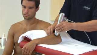 Radial Shockwave Therapy  Radial Pulse Therapy [upl. by Rosena]