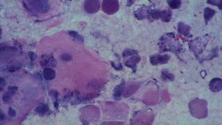 Gynaecology Cervical canal Cytological examination [upl. by Anuqahs]