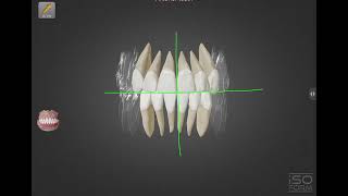 Basic concept of Tooth  Episod 01  Firoj Ahmed Fahim  MediVerse [upl. by Ferree]