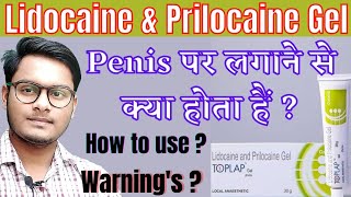 Lidocaine prilocaine cream  Lidocaine and prilocaine cream usp  Toplap gel  Toplap gel in hindi [upl. by Edmunda]