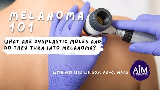 What are Dysplastic Moles and Do They Turn into Melanoma [upl. by Vanthe]