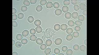 White Blood Cells Crawling Under The Microscope  1000x magnification [upl. by Wheeler]