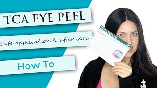 TCA Eye Peel Tutorial  Demonstration  After Care [upl. by Ettenrahc]