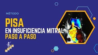 🆓TE LO EXPLICO PISA en INSUFICIENCIA MITRAL PASO A PASO⚠️ [upl. by Mcclish471]