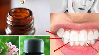 Which Essential Oils Help To Stop Grinding The Teeth During Sleep  Treat Grinding Teeth With Oils [upl. by Llerrut]